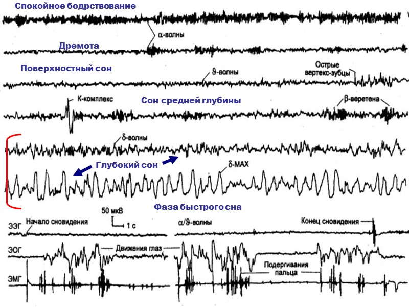 Спокойное бодрствование Поверхностный сон Дремота Сон средней глубины Глубокий сон Фаза быстрого сна